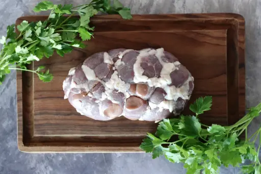 [015] Riñon con grasa